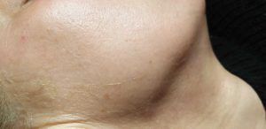 skin and clear skin
