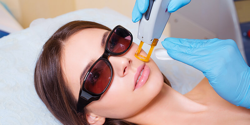 Face Laser Hair Removal