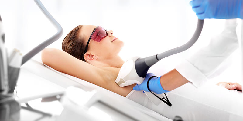 Underarm Laser Hair Removal