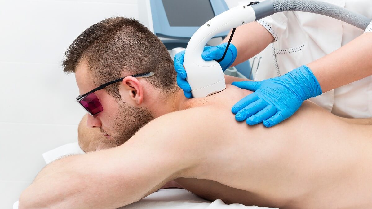 Laser Hair Removal On Back