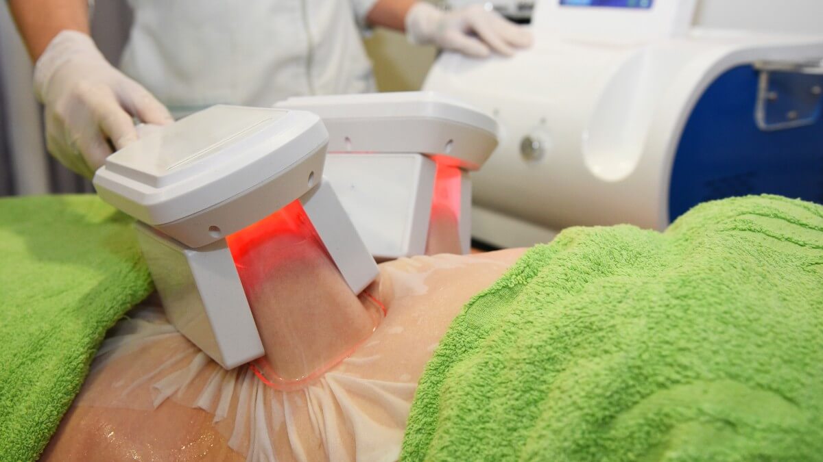 Fat Freezing Procedure