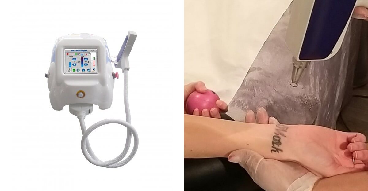 Laser Tattoo Removal Machine