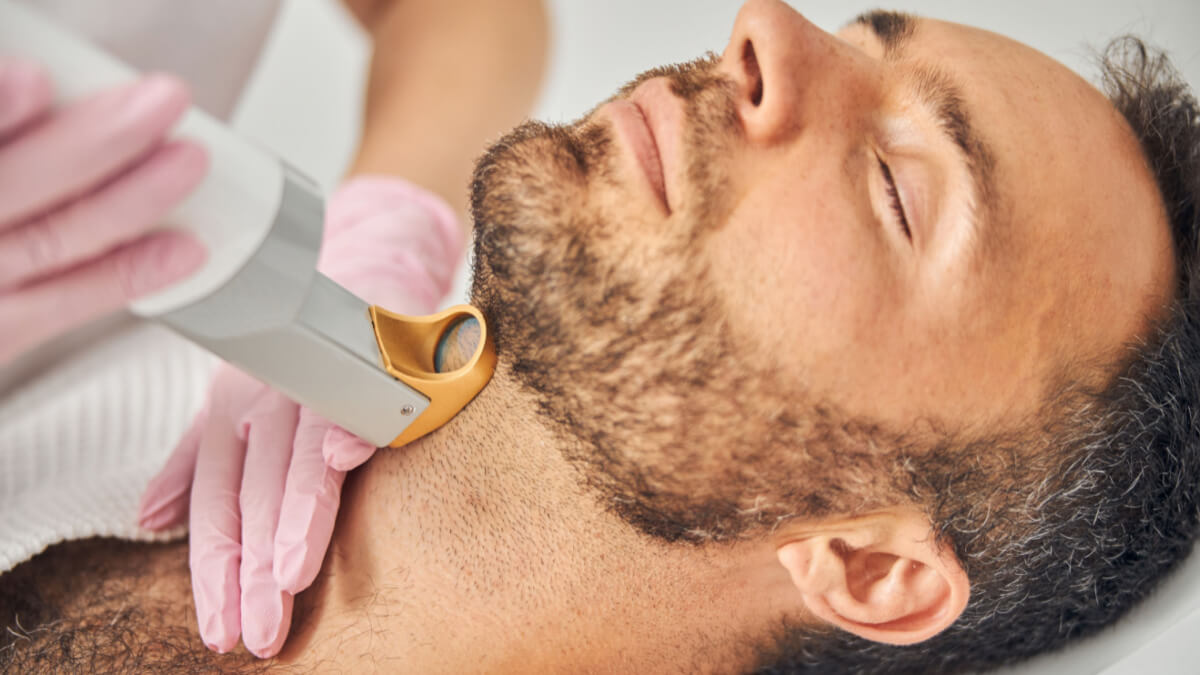 Neck Laser Hair Removal