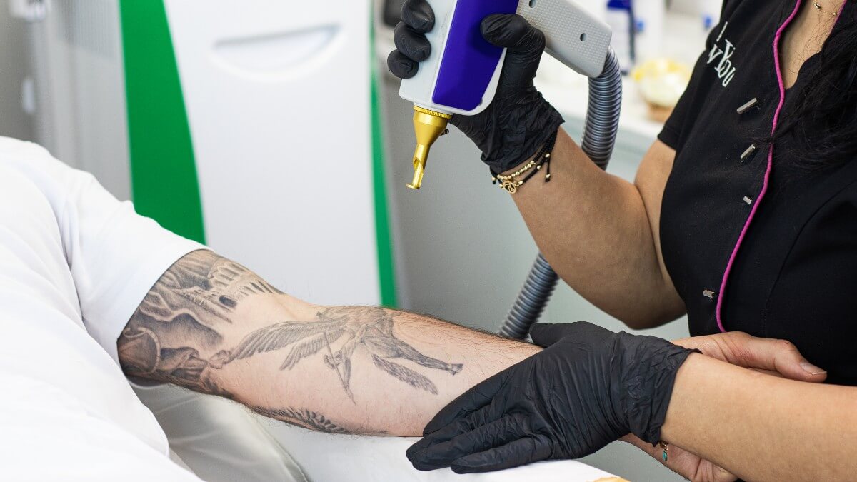 Cosmetic Tattoo Removal  Lightening  Skincare Laser Clinic