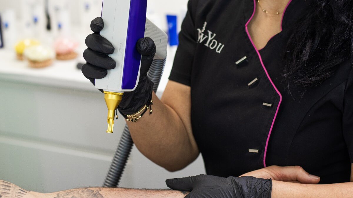 Practitioner Doing Laser Tattoo Removal